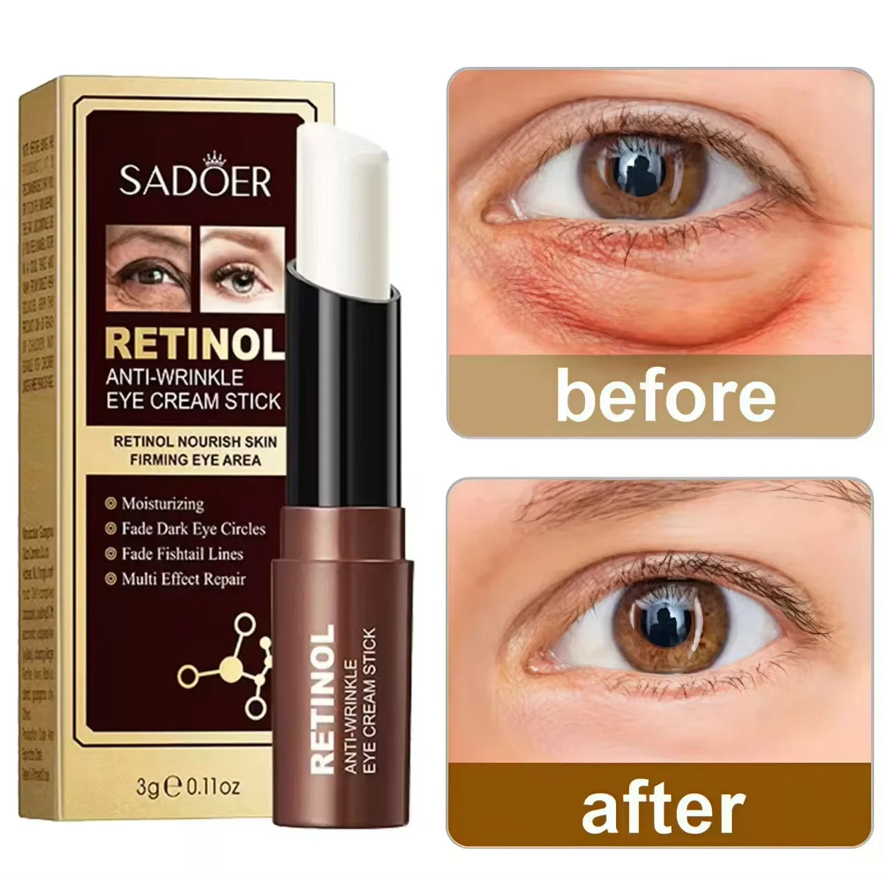 Instant Eye Bag Removal Cream Retinol Anti-Wrinkle Firming Skin Fade Fine Lines Anti Dark Circle Puffiness Brighten Eye skinCare MLADC & P